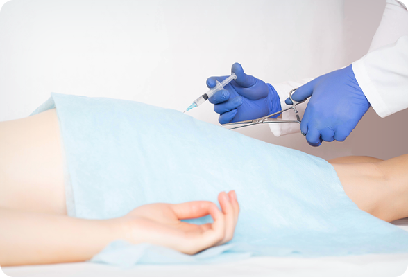 1 いぼ痔(内痔核)は切らずにジオン注射で治療可能